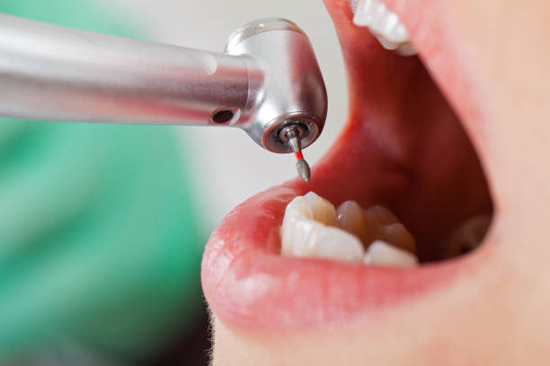 Best Tooth Infection Emergency Dentist  in Dumas, AR